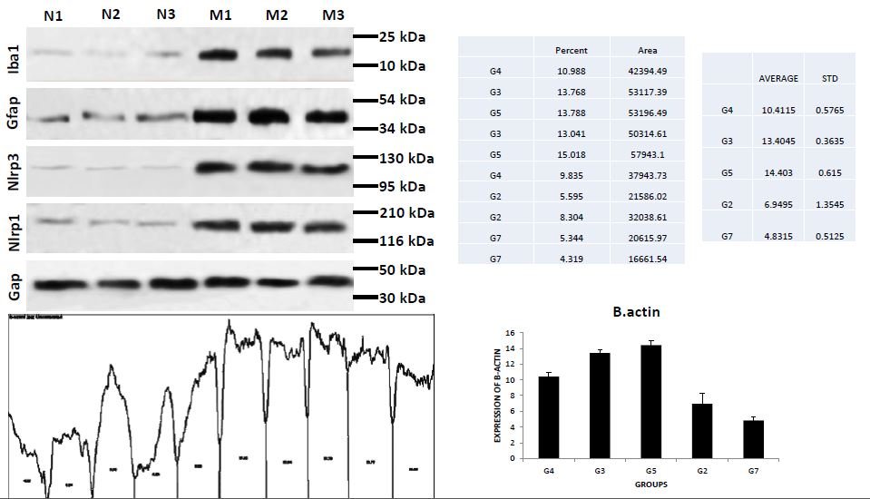 The interpretation of paper and unusual bands in Western Blot