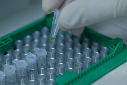 سنتز cDNA از RNA استخراج شده از سلول و بافت
