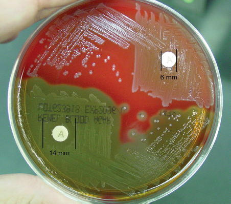تست های بیوشیمیایی تشخیص باکتری ها
