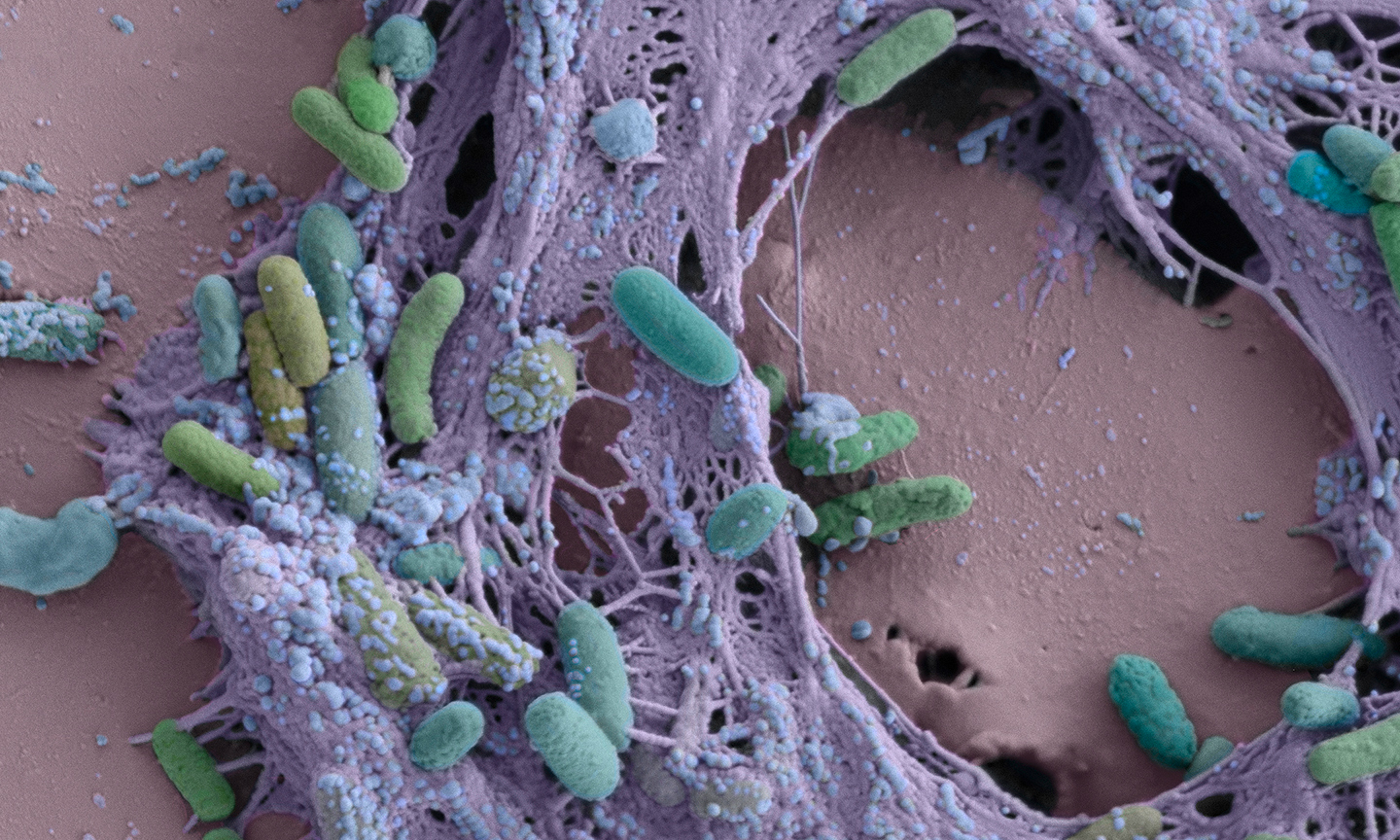 بیوفیلم ميكروبي