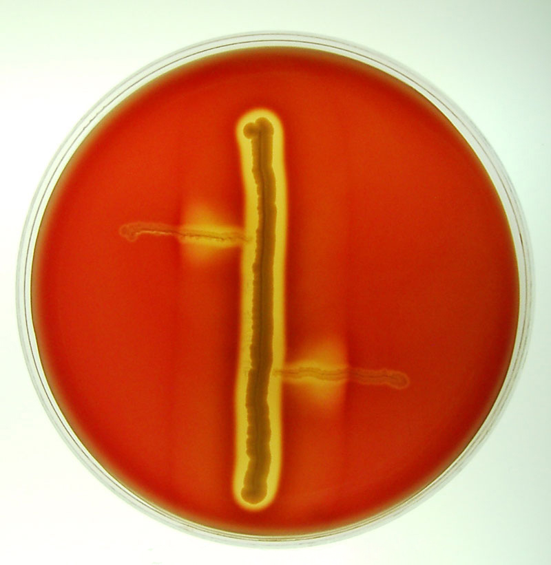 تست های بیوشیمیایی تشخیص باکتری ها