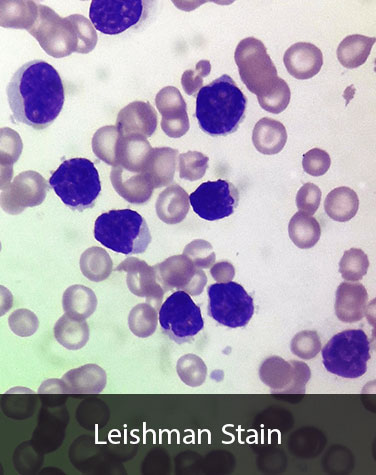 رنگ آمیزی اختصاصی سلول های خونی - لیشمن