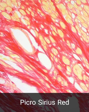 رنگ آمیزی اختصاصی بافت قلب - رنگ پیکروسایروس رد - هیستوژنوتک