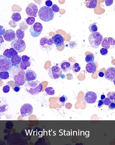 رنگ آمیزی اختصاصی سلول های خونی - رایت گیمسا - هیستوژنوتک