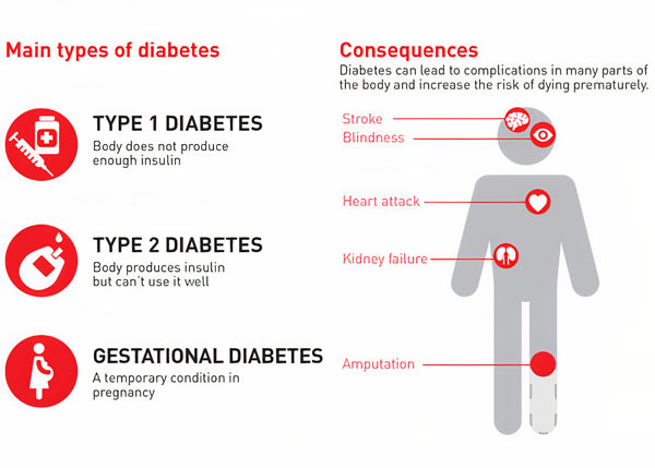 انواع دیابت - پژوهش های مرتبط با دیابت - هیستوژنوتک