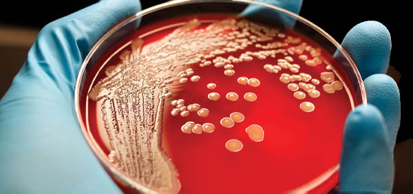 رشد باکتری بروی محیط کشت آگار خوندار (Blood agar)