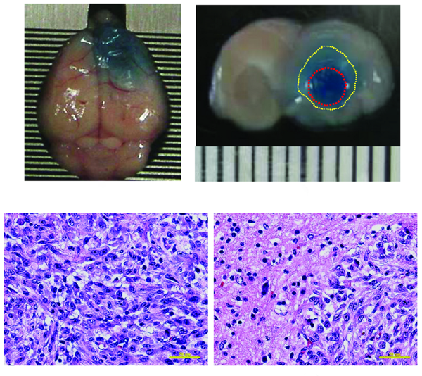 نفوذ رنگ اوانس بلو به سد خونی مغزی در اثر القا تومور