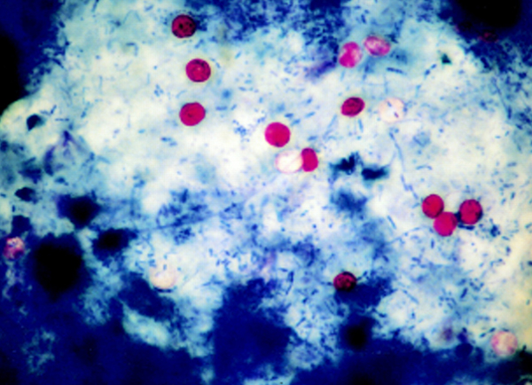 رنگ آمیزی اسید فست انگل کریپتوسپوریدیوم پارووم، انگل ها به رنگ قرمز مشخص اند