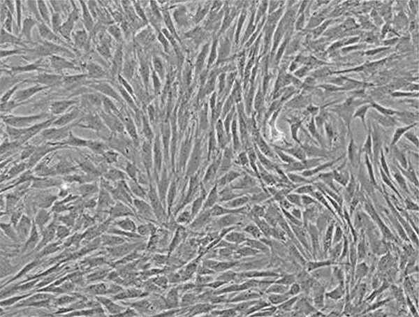 سلول های بنیادی مزانشیمی دوکی شکل 