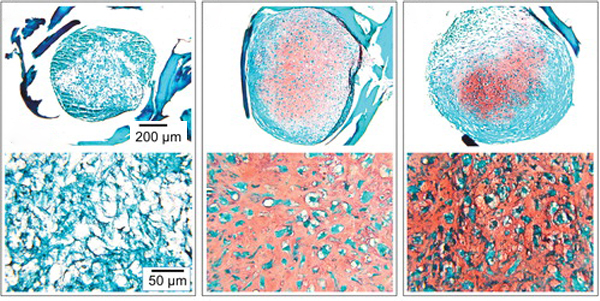تمایز و تکثیر سلول های بنیادی مزانشیمی به غضروف