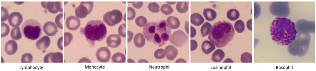 پنج نوع از سلولهای سفید در خون محیطی نرمال - رنگ آمیزی گیمسا