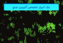 رنگ آمیزی آکریدین اورنج در بافت شناسی - هیستوژنوتک