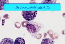 رنگ آمیزی اختصاصی سودان بلک - هیستوژنوتک