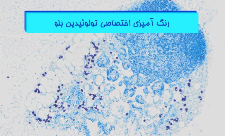 رنگ آمیزی اختصاصی تولوئیدین بلو