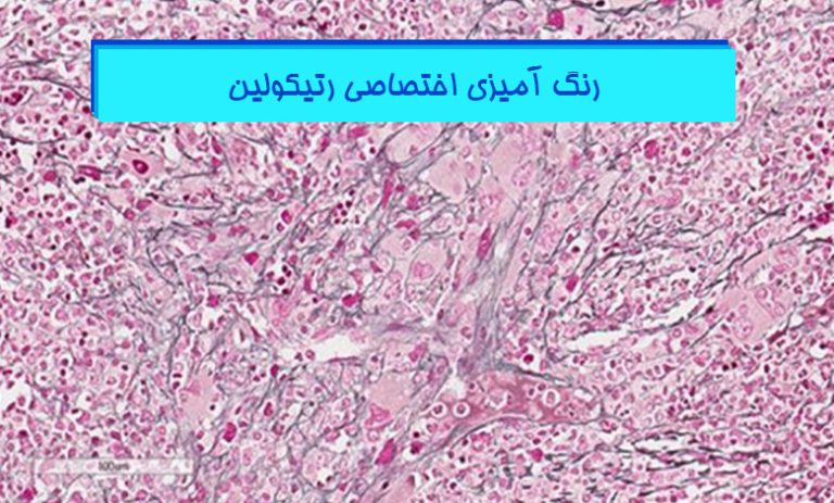 رنگ-آمیزی-اختصاصی-رتیکولین-در-بافت-شناسی-هیستوژنوتک