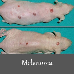 انواع القای مدل های بیماری - سرطان پوست