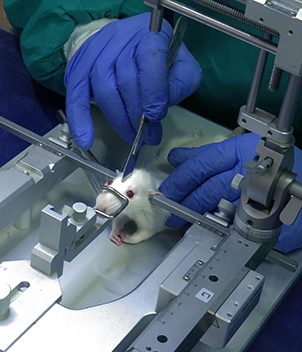 آلیزایمر-بالای-صفحه