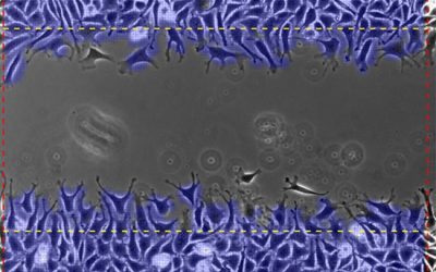 آنالیز تست خراش - شرکت دانش بنیان بافت و ژن پاسارگاد