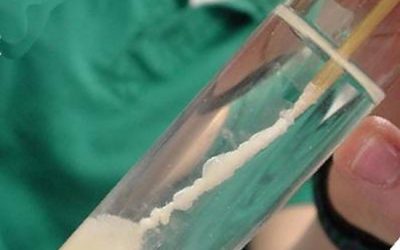 استخراج DNA از بزاق - شرکت دانش بنیان بافت و ژن پاسارگاد