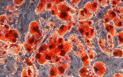 تمایز به چربی (تأییدیه با اویل رد) - شرکت دانش بنیان بافت و ژن پاسارگاد