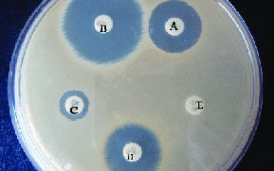 تست-حساسیت-آنتی-بیوتیکی-مقاوم-به-متی-سیلین(DDM)
