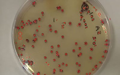 شمارش کلنی - شرکت دانش بنیان بافت و ژن پاسارگاد