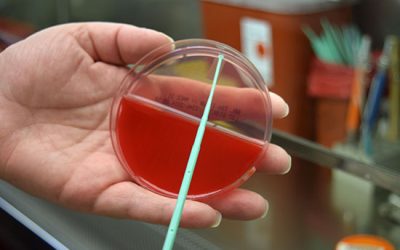 شمارش کلنی - شرکت دانش بنیان بافت و ژن پاسارگاد