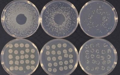 تست کلنی کانت با روش پخش کردن در محیط کشت - شرکت دانش بنیان بافت و ژن پاسارگاد