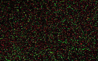 رنگ آمیزی آکریدین اورنج برای بررسی مرگ و میر - شرکت دانش بنیان بافت و ژن پاسارگاد