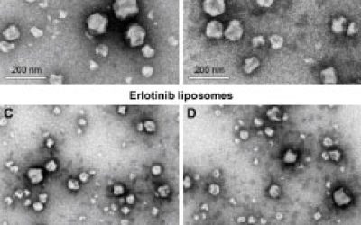 سنتز نانوذرات لیپوزوم - شرکت دانش بنیان بافت و ژن پاسارگاد