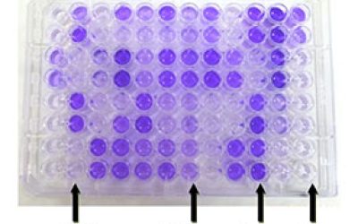 سنجش-بیوفیلم--