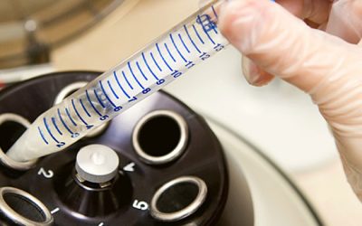 شستشوی اسپرم - شرکت دانش بنیان بافت و ژن پاسارگاد