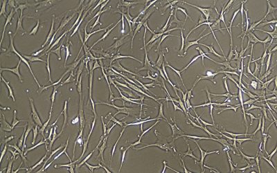 مزانشیم مغز استخوان - شرکت دانش بنیان بافت و ژن پاسارگاد