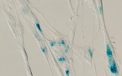 lung-fibroblasts-سایت