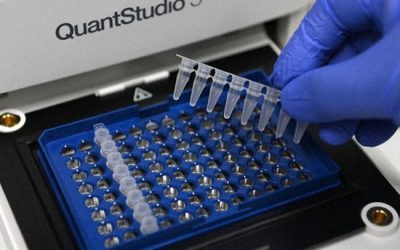 انجام تکنیک PCR بررسی بر روی ژل الکتروفورز - شرکت دانش بنیان بافت و ژن پاسارگاد