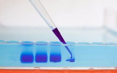 انجام تکنیک PCR بررسی بر روی ژل الکتروفورز - شرکت دانش بنیان بافت و ژن پاسارگاد
